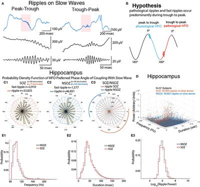 Ripples Have Distinct Spectral Properties and Phase-Amplitude Coupling With Slow Waves, but Indistinct Unit Firing, in Human Epileptogenic Hippocampus